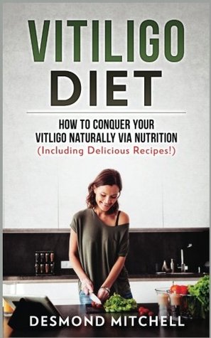 Full Download Vitiligo Diet: How To Conquer Your Vitiligo Naturally Via Nutrition (Including Delicious Recipes!) - Desmond Mitchell file in PDF